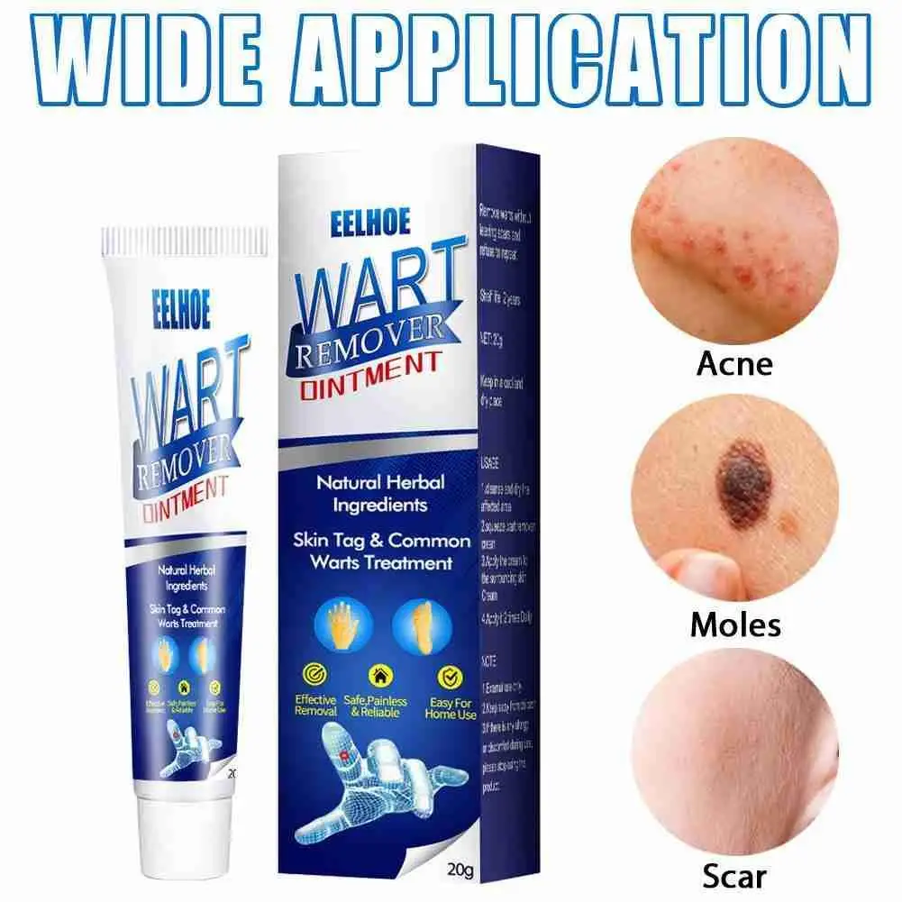 

1pcs Instant Blemish Removal Gel Wart Removal Body Warts Treatment Cream Foot Care Cream Skin Tag Remover Wart Cream