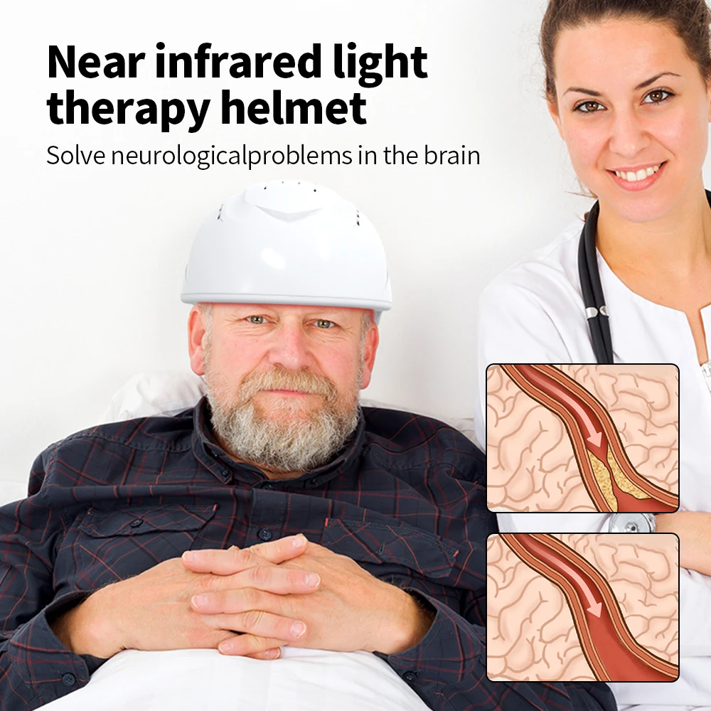 Новое физиотерапевтическое оборудование инфракрасная терапия Альцгеймера 810 нм