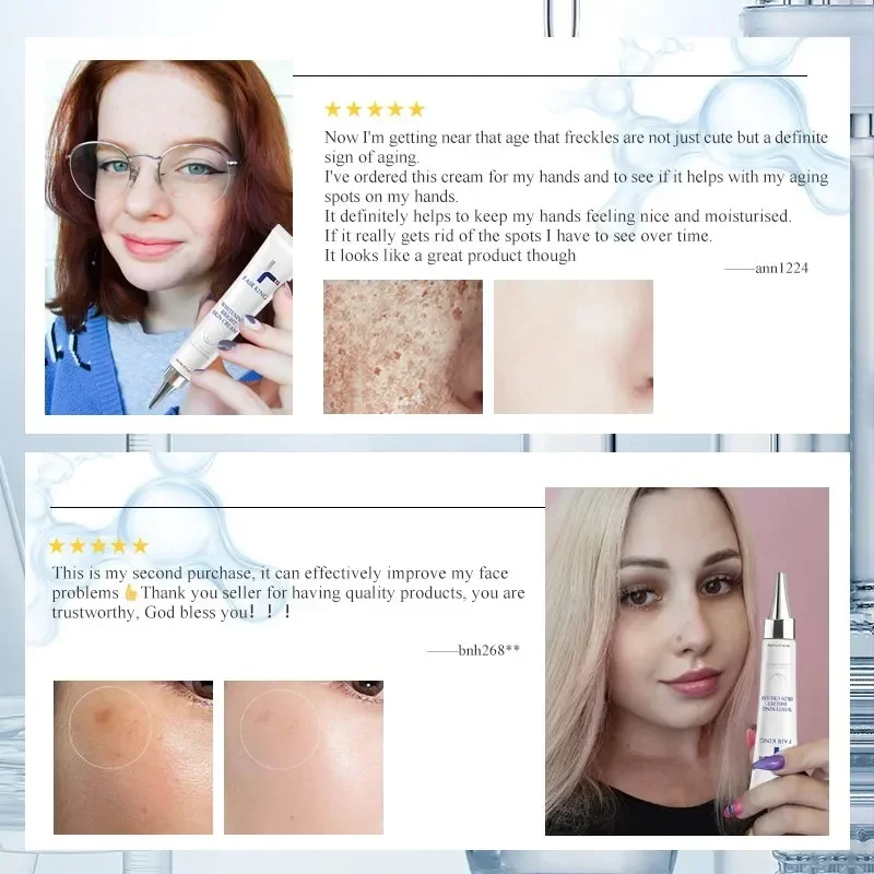 Мощный отбеливающий крем для ухода за кожей удаляет веснушки мелазму корректор