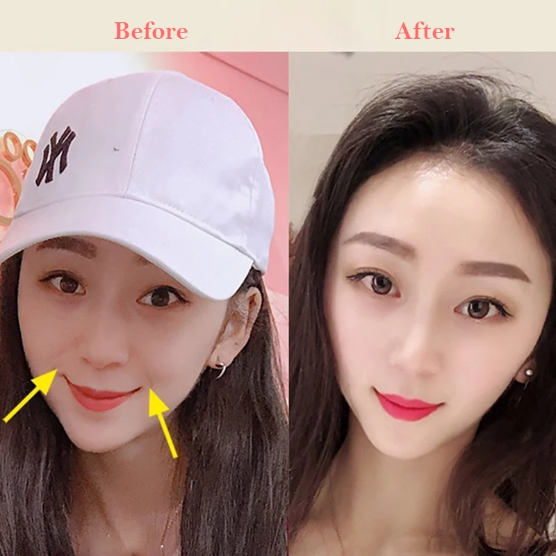 Шарики для подтяжки лица инструмент похудения устройство ухода за кожей против