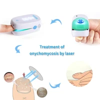 infrared nail fungus laser treatment instrument feet care whitening toes nail fungus removal anti infective onychomycosis