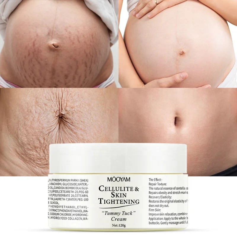 

Organic Stretch Mark Removal Cream Treatment Repair Anti Pimples Acne Scar Removing Tummy Tuck Cream