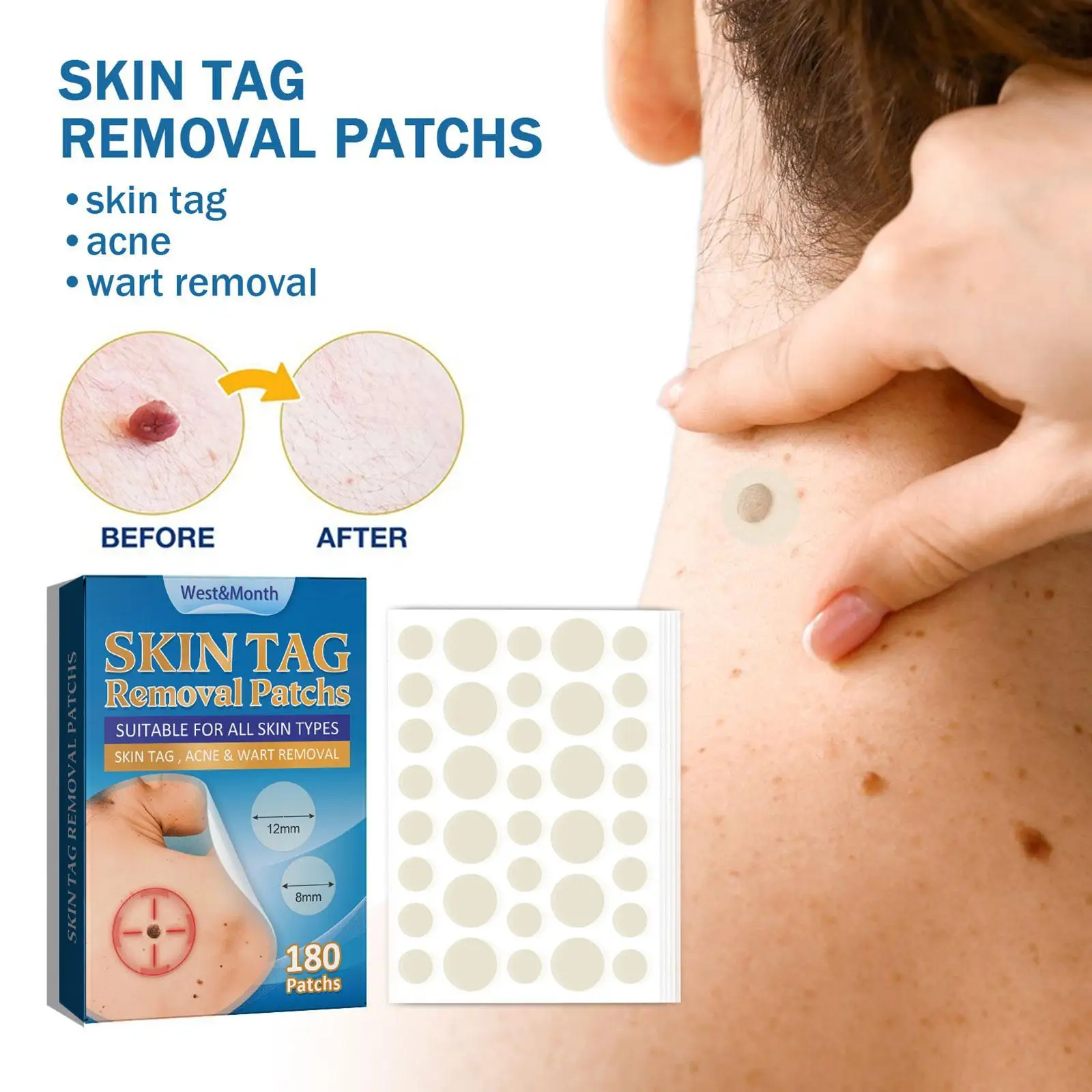 

180pc/box Warts Remover Patch Skin Tags Pimple Treatments Cream Hydrocolloid Gel Foot Corn Plaster Acne Warts Invisible Stickers