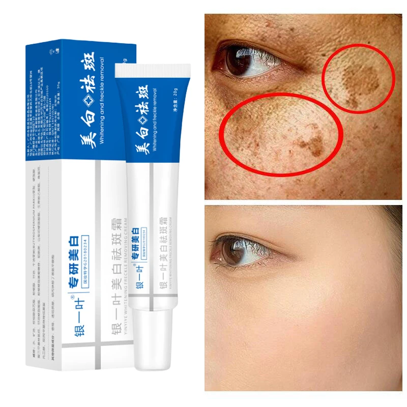 Niacinamide отбеливающий крем для веснушек средство удаления темных пятен осветления