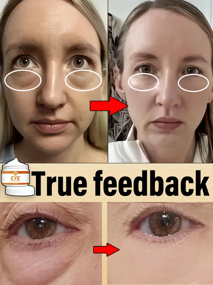 Электронное портативное женское косметическое оборудование для удаления мешков