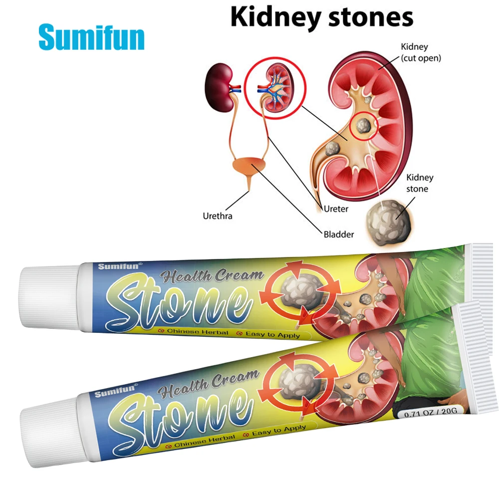 

Sumifun 20g Kidney Stones Removal Cream Treat Gallstones Renal Calculus Medical Plaster Urolithiasis Pain Relief Health Ointment