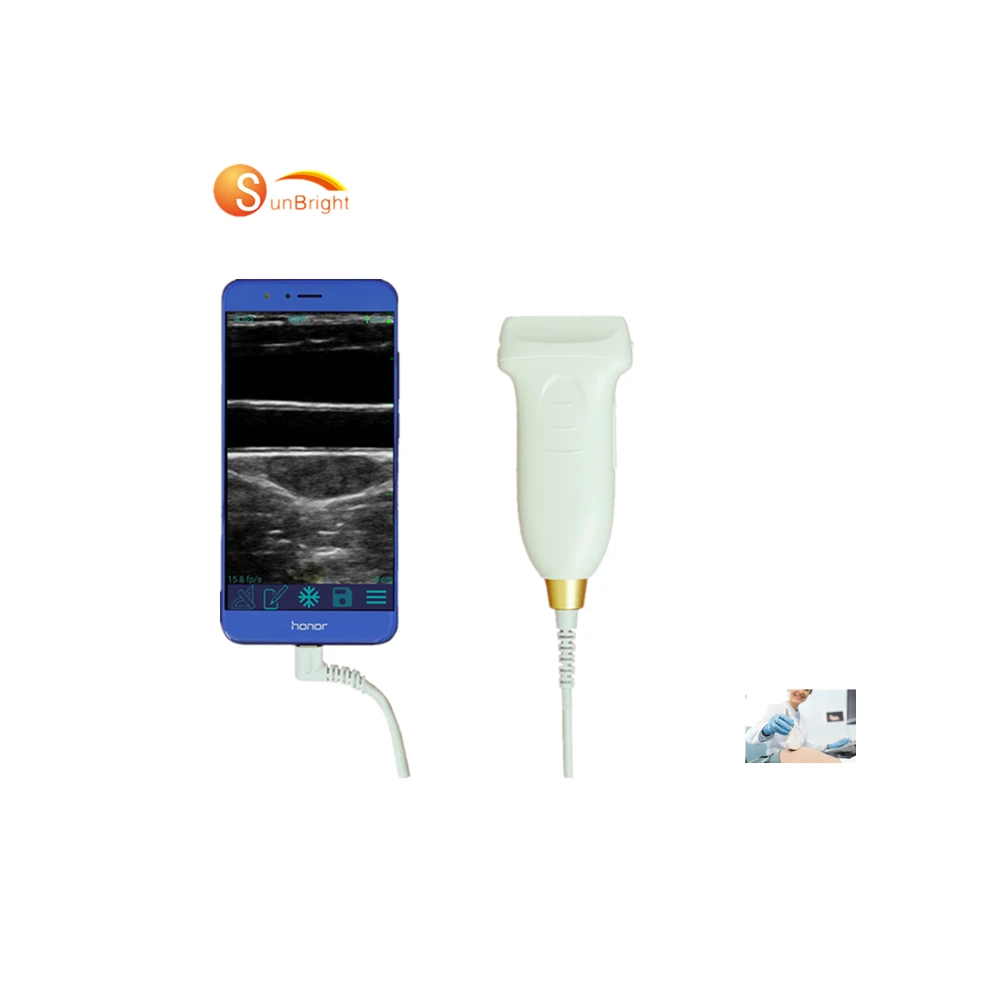 

Medical ultrasound instruments portable convex probe handheld ultrasound wireless probe