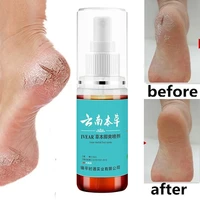 yunnan traditional herbal medicine beriberi spray anti drying repair heel cracking repair heel cracking repair spray