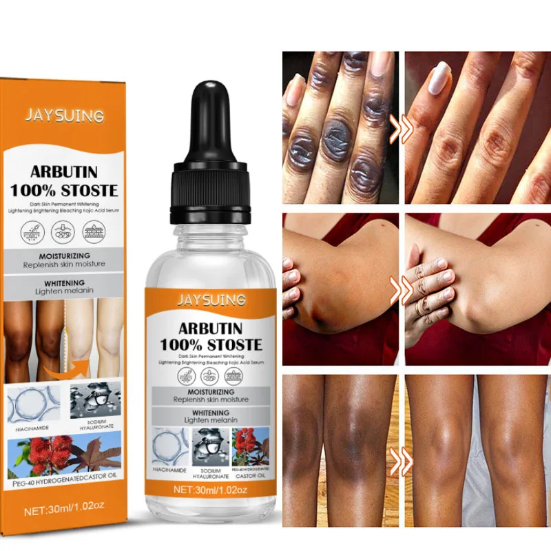 

Niacinamide Body Whitening Serum Knuckle Removal Melanin Knee Hips Private Parts Bleaching Improve Dull Brightening Skin Care