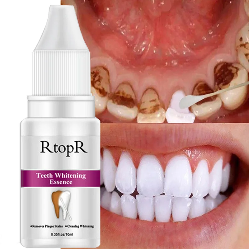 

Teeth Whitening Essence Cleanning Stains Oral Hygiene Removes Breath Freshen Mousse Foam Portable Travel Toothpaste Suit