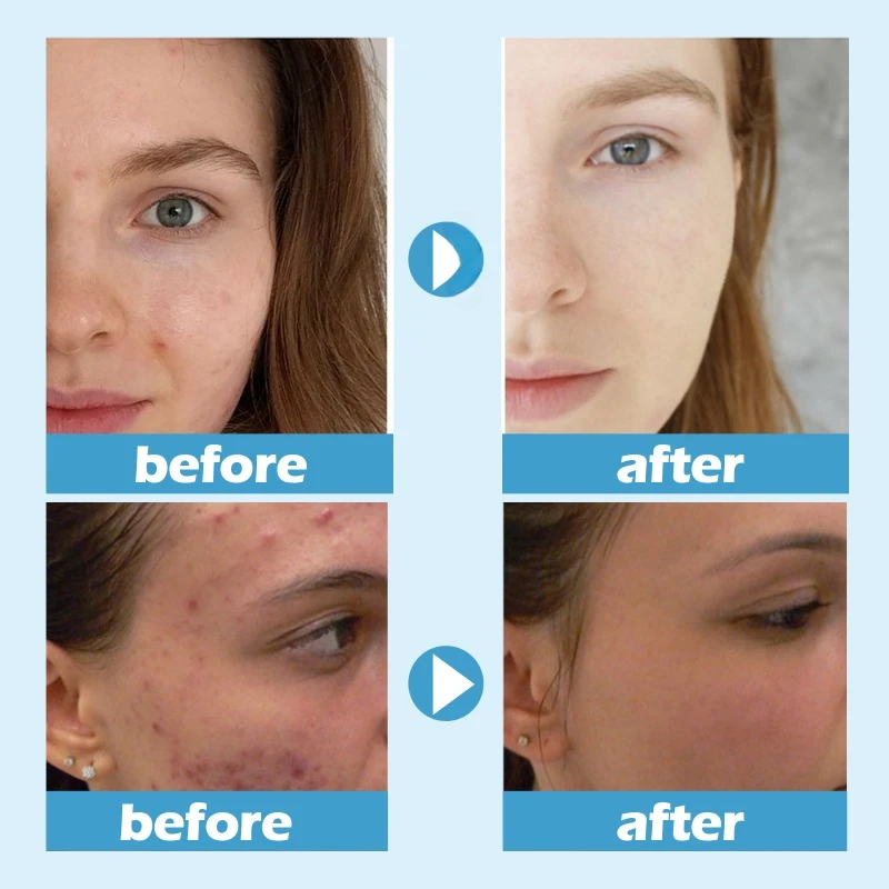 Влажная ледяная маска для сна Hydra отбеливающая Увлажняющая восстанавливающая