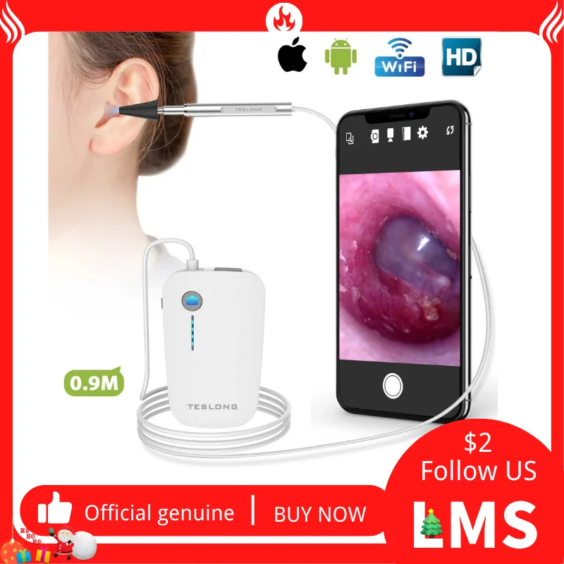 LMS CAP Otoscope Ear 4.3mm Wireless Visual Endoscope Camera 720P HD Inspection Digital Earpick Cleaning Tool for Iphone Android