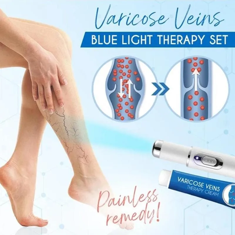 

Varicose Vein Ointment Cream Relieve Swelling Of Varicose Veins In The Leg