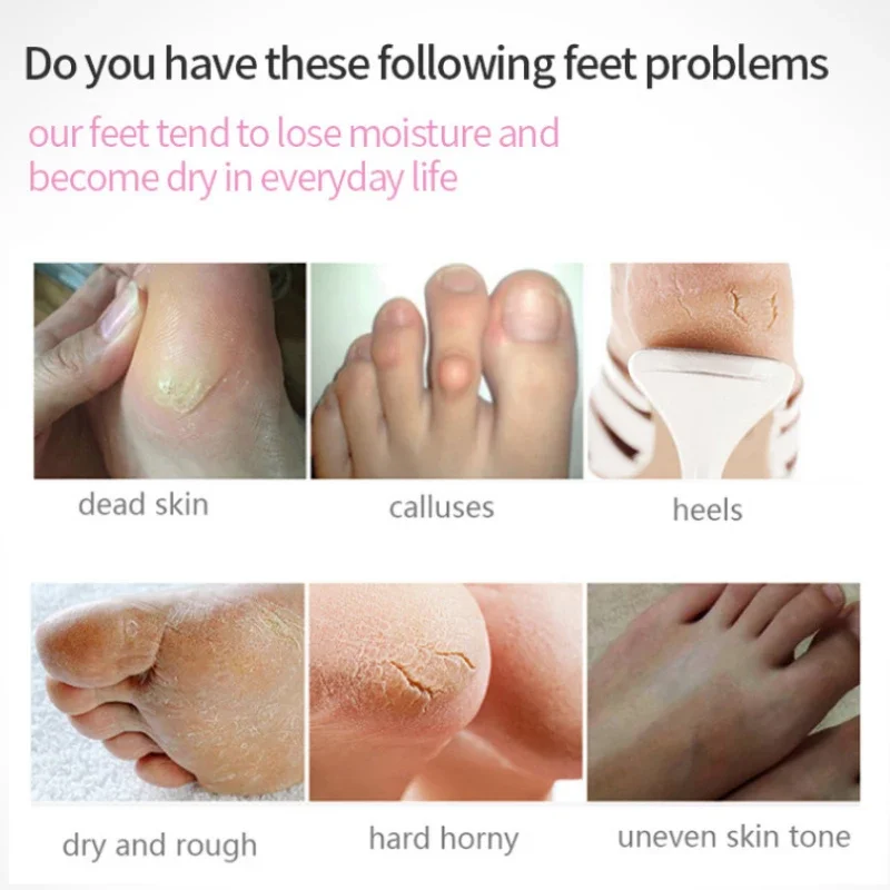 Отшелушивающие маски для ног гладкие удаления мозолей омертвевшей кожи