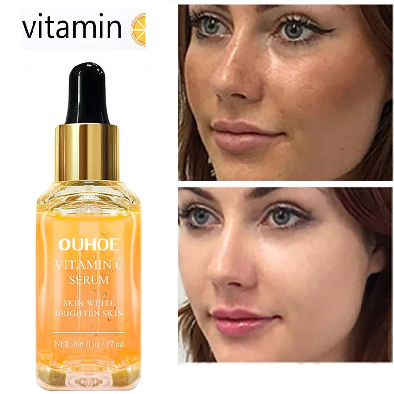Vitamin C Whitening Face Serum Fade Dark Spot Remove Melanin Brighten Essnece Anti-wrinkle Moisturizing Repair Skin Care Product