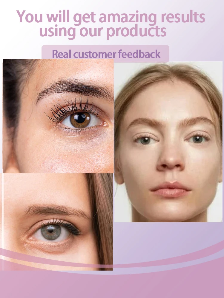 2024 никотинамид крем для глаз темные круги выцветание мешков под глазами