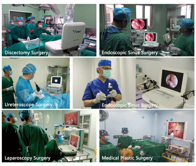 YKD-9003 Портативная эндоскопия FHD все в одном для ЛОР-клинического осмотра и