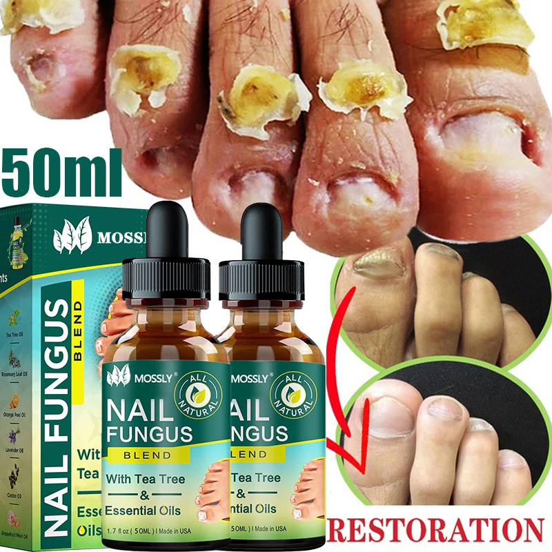 

Nail Repair Serum Nail Fungal Treatment Serum Onychomycosis Paronychia Anti-Fungal Nail Infection Toe Fungus Foot Repair Care