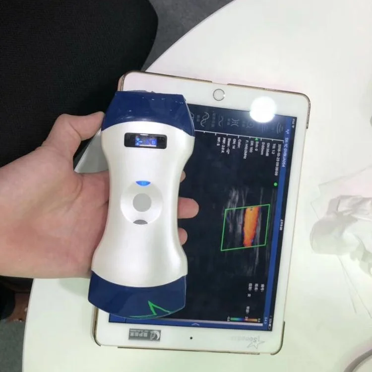 

WIFI Portable Wireless Handheld Double Head Ultrasound Machine Probe