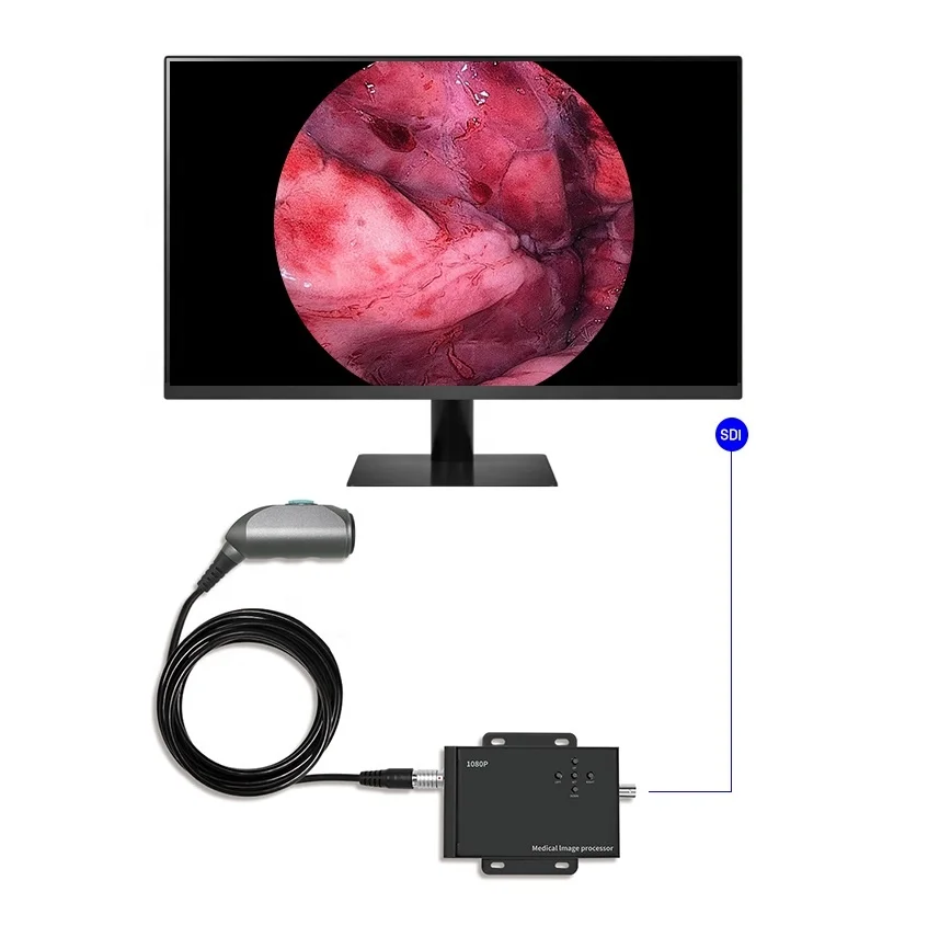 

Factory Price 1080P HD MINI Endoscope Camera Processor Nasal Endoscopy Machine