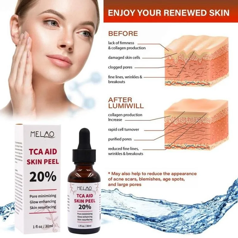 2pcs 30ml Tca Aid Skin Peel Trichloroaectic Acid 20% Skin Peel Pore Minizing Wrinkles  Spots Skin Care Face Serum