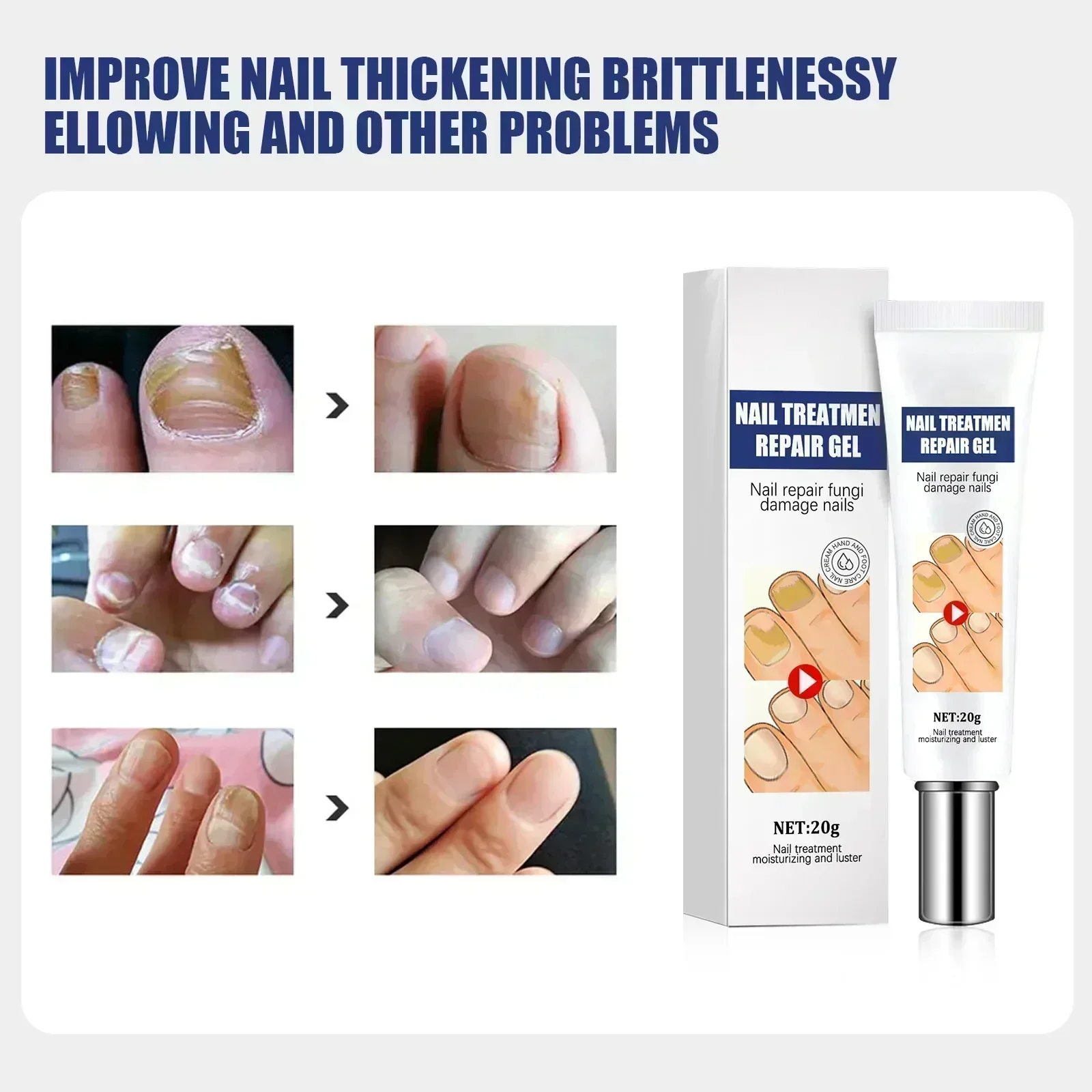 ГОРЯЧАЯ ПРОДАЖА восстановление грибка ногтей ремонт для обесцвеченных