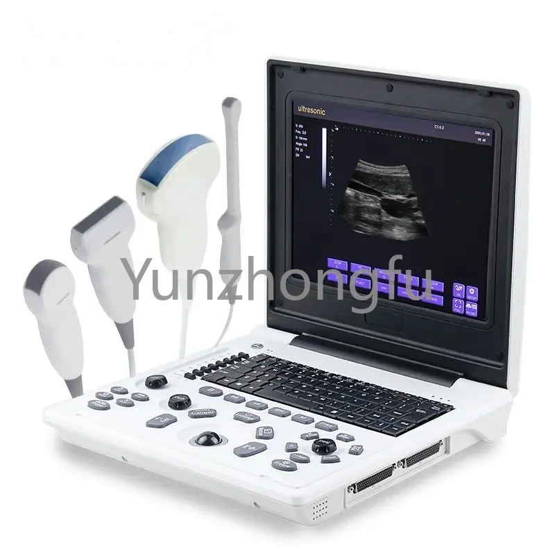 

Сканер USG, цифровые инструменты для эхокардиографии, ультразвуковой портативный медицинский ультразвуковой аппарат для ультразвуковой эхокардиографии с чёрно-белым ноутбуком