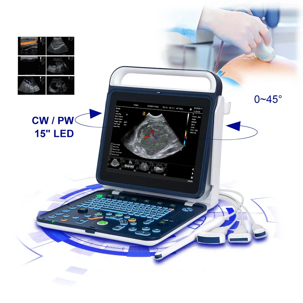 MY-A027E Mayamed портативный ноутбук ecografo ультразвуковой аппарат цветной Доплер сканер