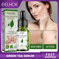green tea shrinking pores face serum gentle moisturizing whitening essence oil control remove blackhead acne treatment skin care