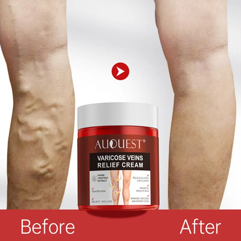 

For Legs Muscle Pain Relief Improve Blood Circulation Varicose Veins Body Care