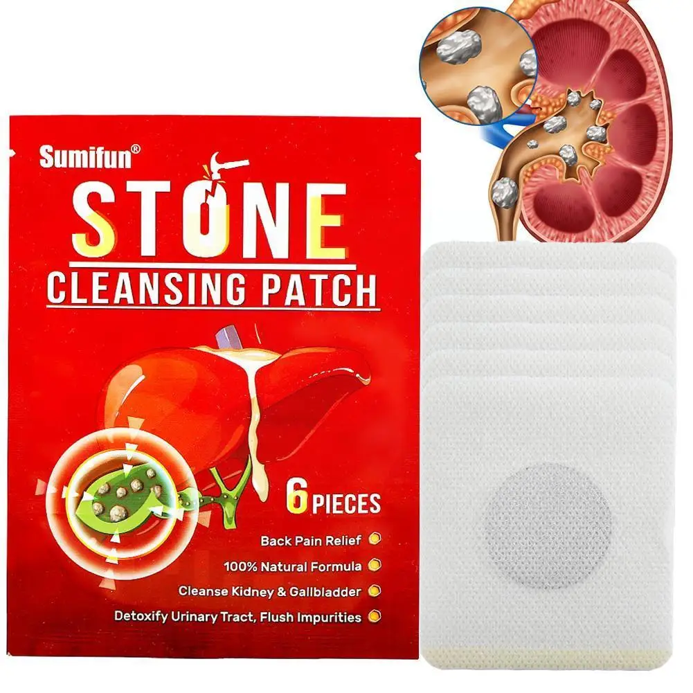 

6 шт., китайские лекарственные камни для почек и почек