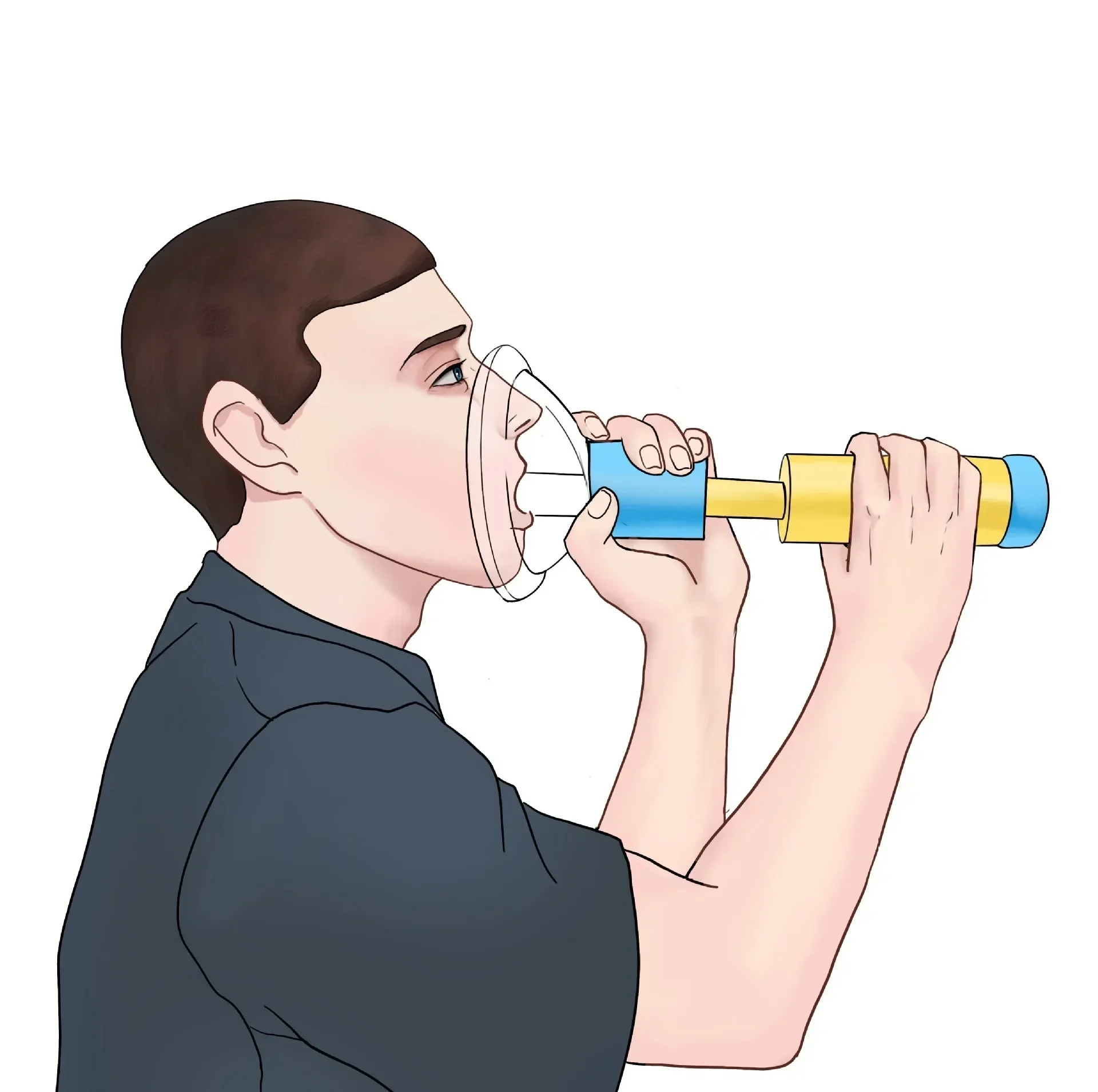 Модернизированное портативное устройство против удушения аварийный