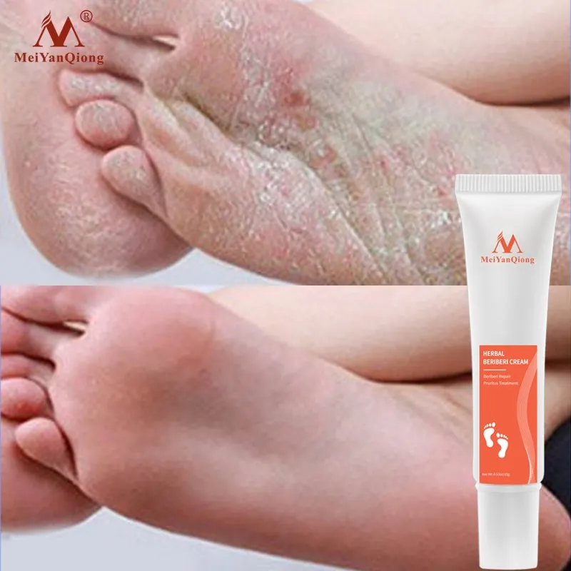 

Remove Foot Odor Foot Cream Foot Care Anti-Drying Heel Cracked Repair Cream Removal Dead Skin Feet Care Fungus Treatment For Leg