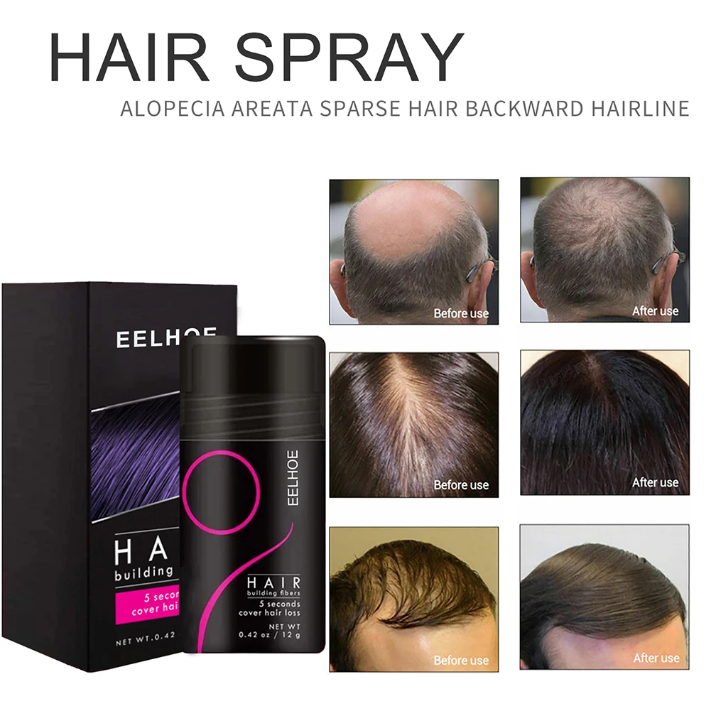 

12g Keratin Hair Building Fibers Hair Loss Treatment Care Conceal Thinning Hair Fiber Eyelash Hair Loss Care Treatment