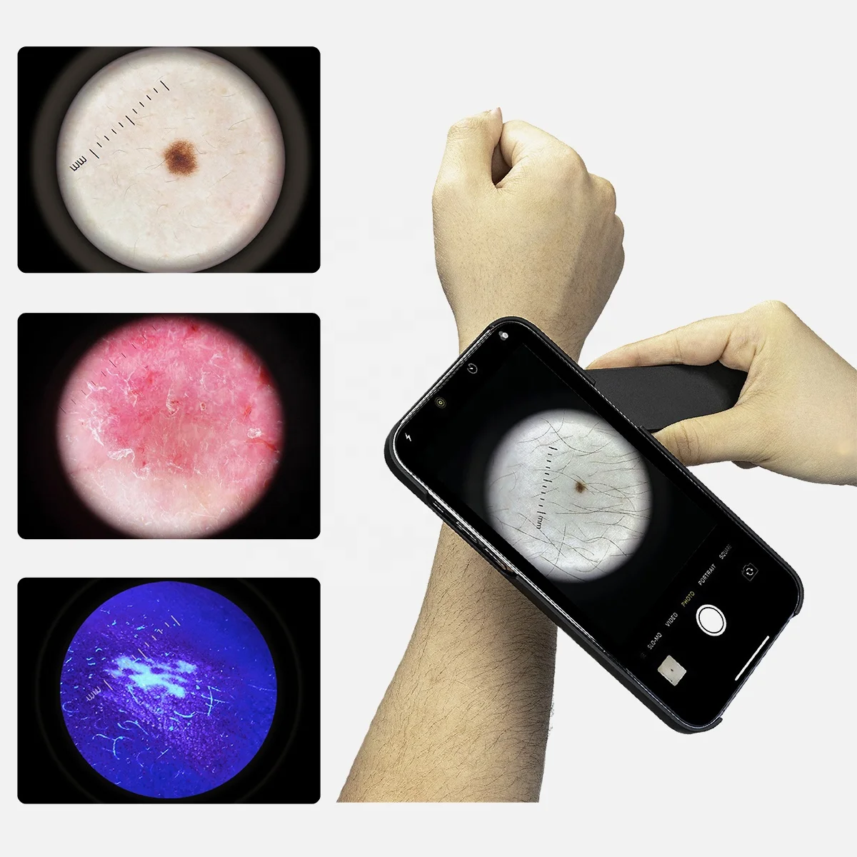 DE4100 PRO Профессиональный источник УФ-излучения для осмотра кожи эквивальная