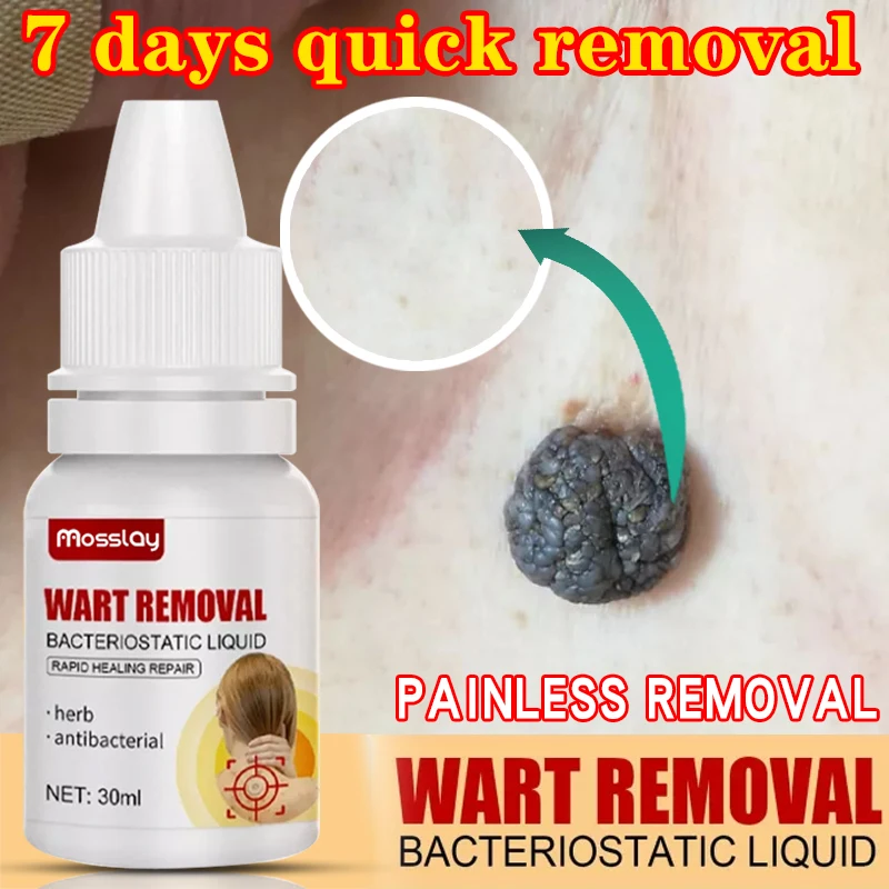 

Organic Tags Solutions Serum Painless Mole Skin Dark Spot Remover Serum Freckle Face Wart Tag Removal Essential Oil 50ml