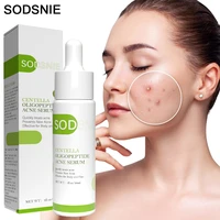 anti acne serum face serum repair nourish remove blackheads acne marks improve rough whitening skin care oligopeptide 30ml