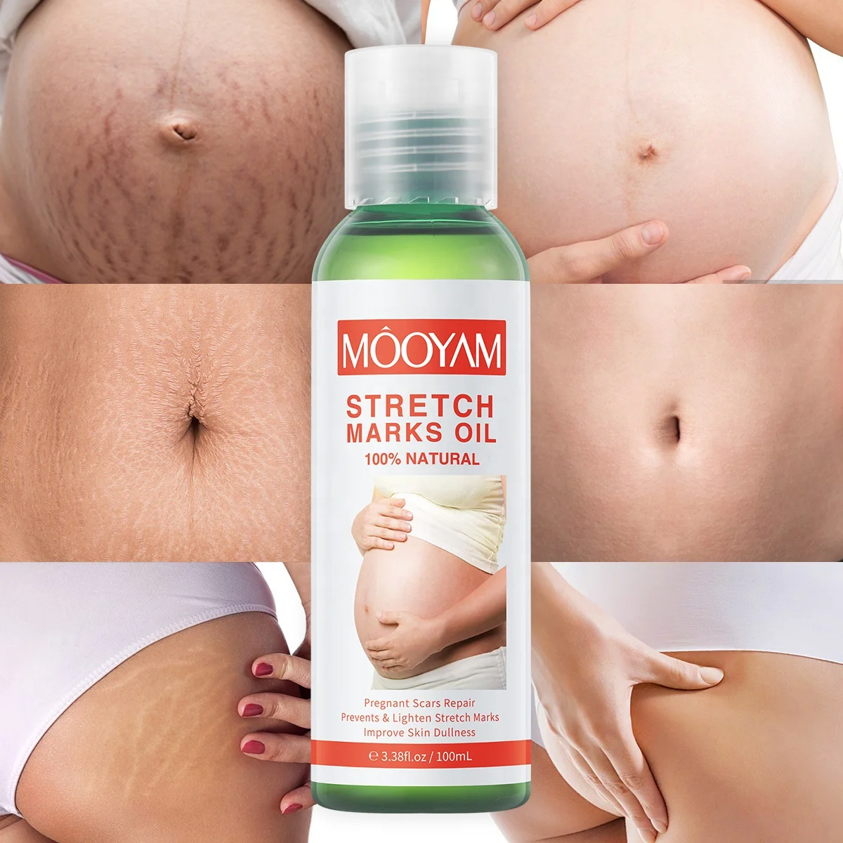 

Pregnancy Scars Remove Stretch Marks Oil Treatment Maternity Repair Anti-Aging Anti-Wrinkles Firming Stretch Mark Body Oil 100ml
