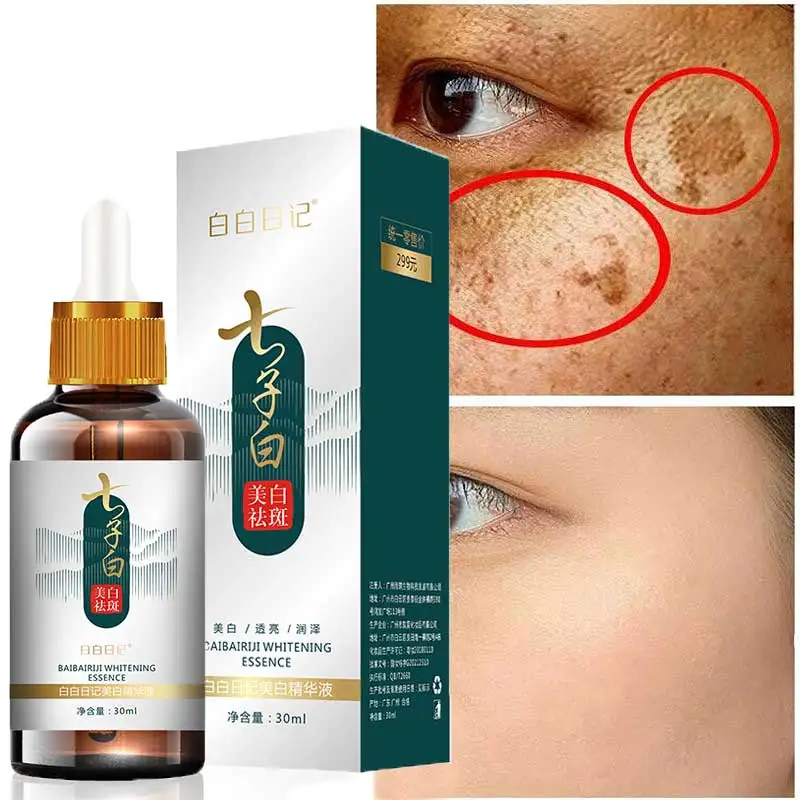 

Effective Whitening Serum Remove Dark Spots Freckle Essence Anti-Aging Fade Pigmentation Melasma Brighten Beauty Face Skin Care