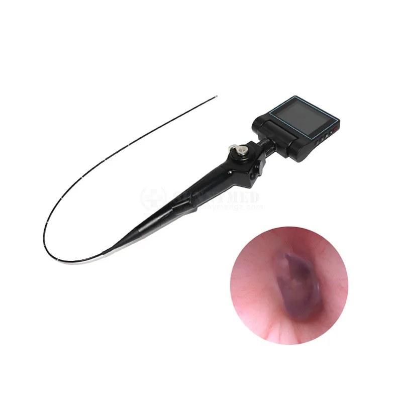 

Discounted SY-P029-1 Sunnymed Video Endoscope Medical ENT Endoscopy Price