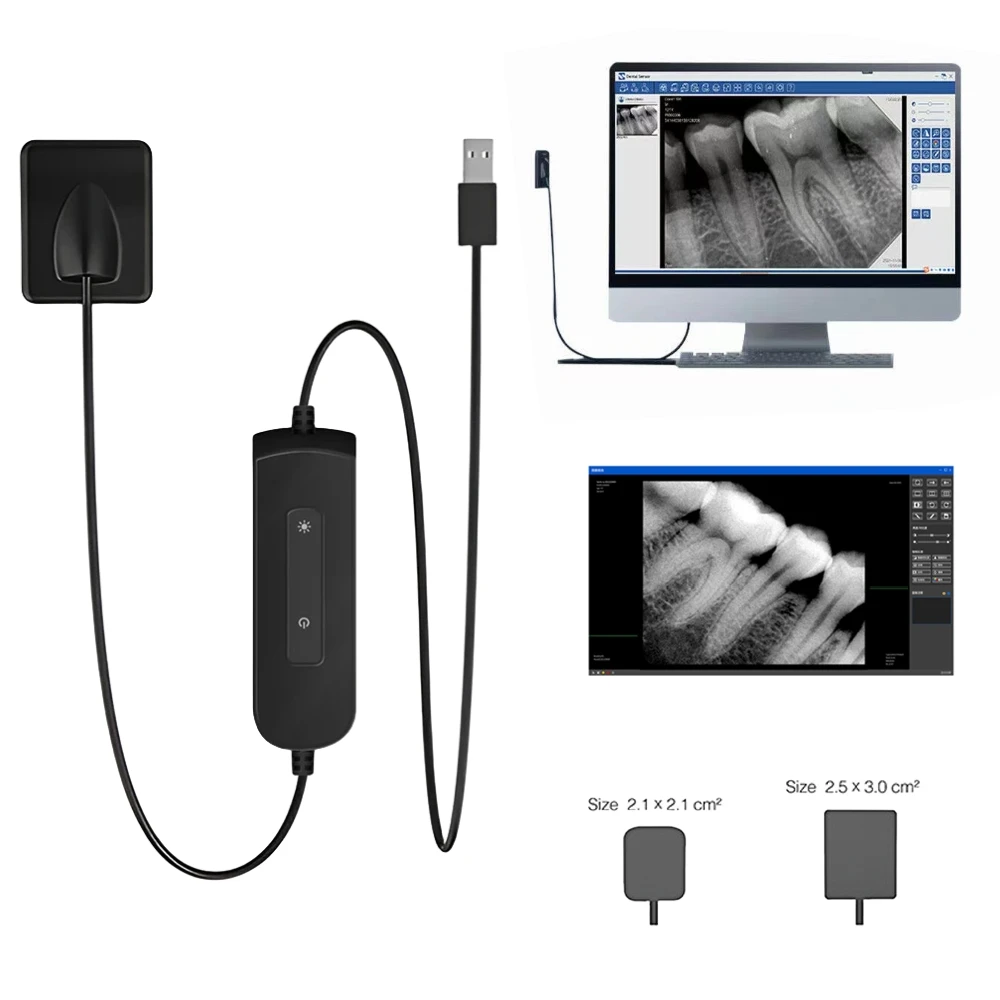 Датчик стоматологии рентгеновский высокочастотный Rx цифровой интраоральный