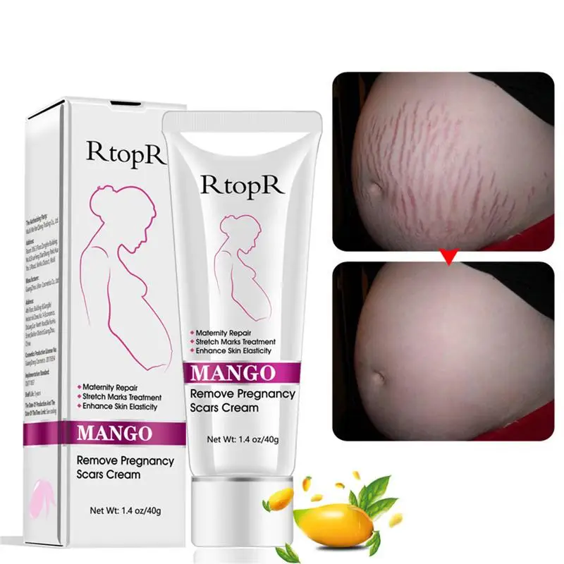 

New Remove Pregnancy Scars Acne Cream Stretch Marks Treat-ment Maternity Repair Anti-Aging Anti-Winkles Firming Body Creams