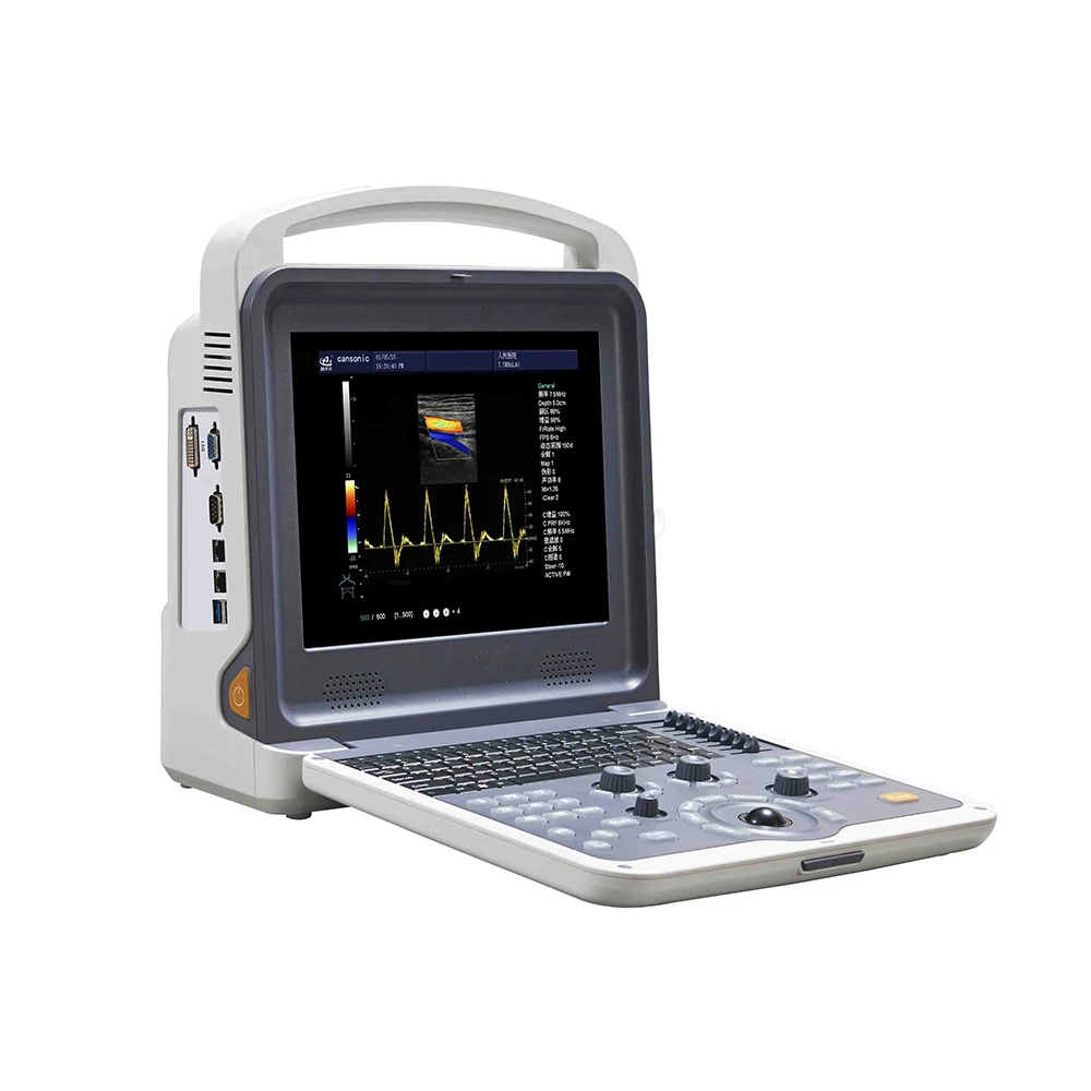 YSB-K2000 Hottest model high resolution 3D 4D color doppler portable ultrasound machines laptop ultrasonic scanner for sale