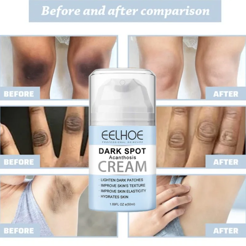 

50ML Whitening Cream Body Brightening Concealer Moisturizing Anti-wrinkle Lifting Firming Facial Cream Skin Care Products