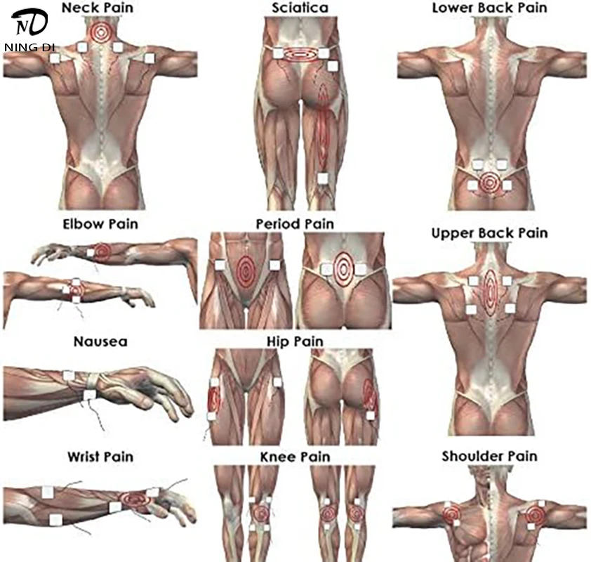 5x5 см десятки блоков 4 шт. сменные детские накладки накладок для электротерапии