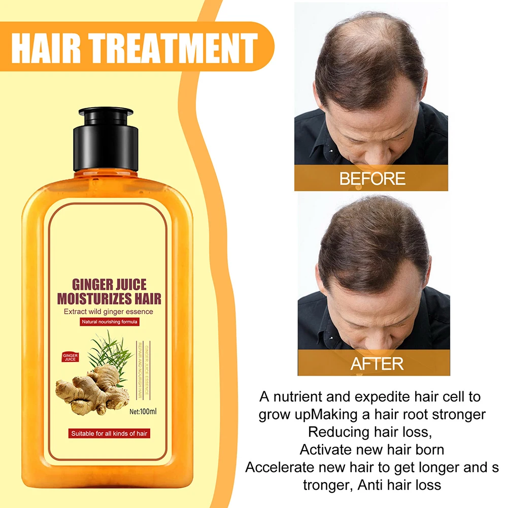 

High Appearance Level Shampoo Herbal Hair Growth Liquid Nourishing Hair Growth Essences All Hair Type Mprove Hair Quality Both