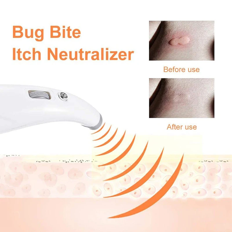 

Mosquito BiteItching Relieving Neutralizer Electronic Therapeutic Agent Antipruritic Calming Device Adjustable Liquid Level