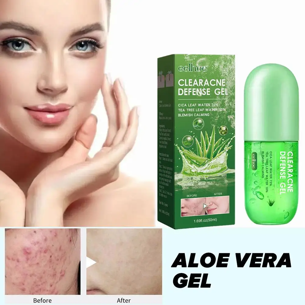 

Aloe Vera Gel ClearAcne Defense Treatment Remove Acne Sunburn Day Skin Body Moisturizer Skin Cream Care Scar Care Gel Repai W9G4