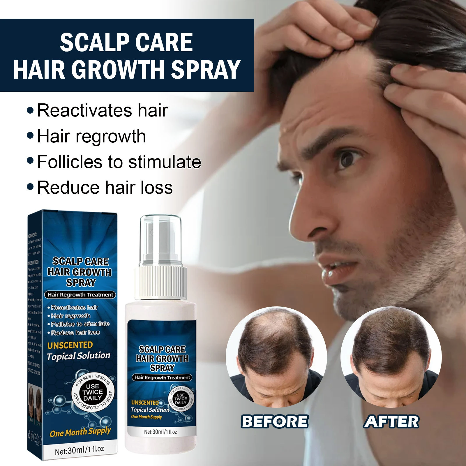 

Раствор для роста волос восстановление поврежденной линии волос спрей густые волосы капсулы Предотвращение выпадения жидкость Alopecia для мужчин женщин эфирное масло