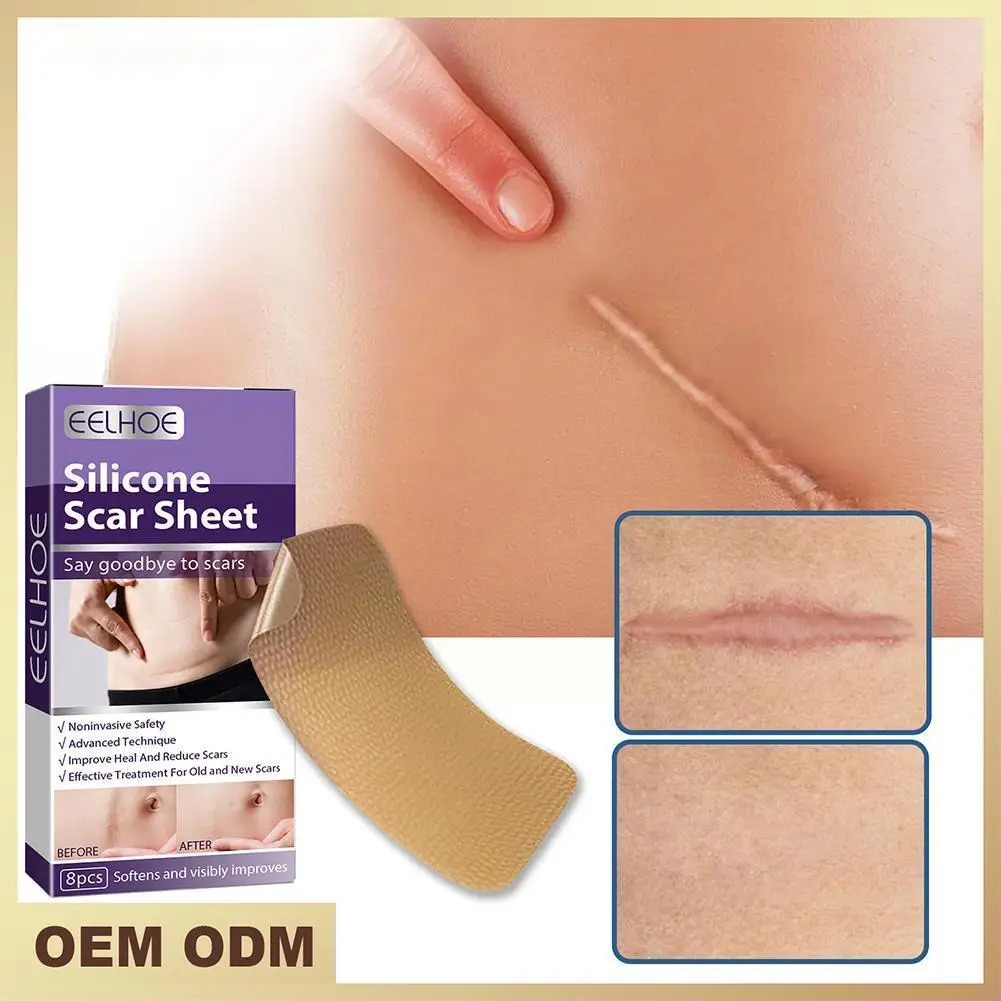 

Silicone Scars Patch Wounds Band Remove Acne Burn Scar Gel Tape Removal Scar Tape Therapy Patch For Acne Trauma Scar Skin R U4I0